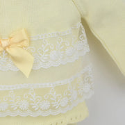 Closer view of the Pex arianna leg warmer set.